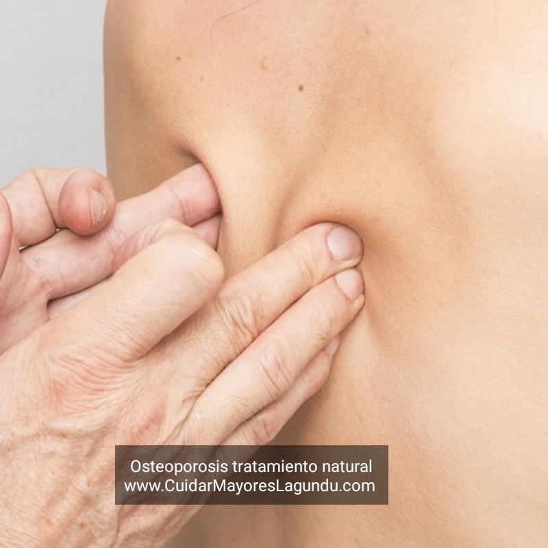 Osteoporosis Tratamiento Natural